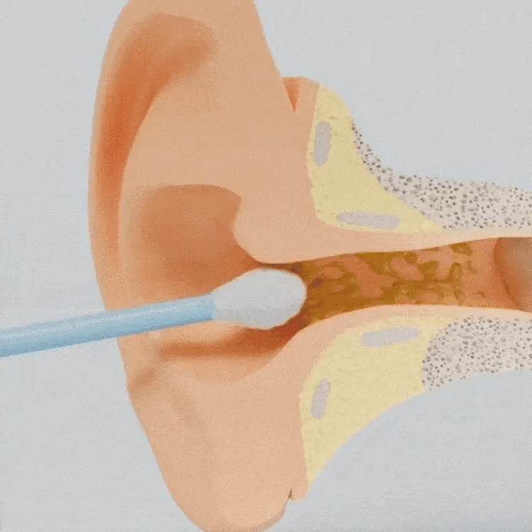 EarClean - Rengöring av öronvax-Hemnix-Hemnix